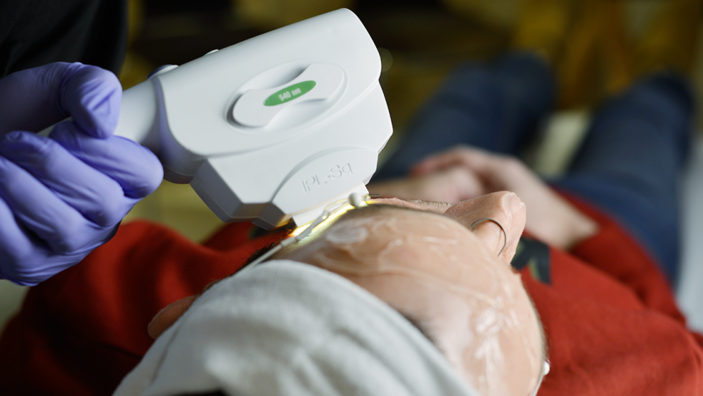 lasers visage sur femmes