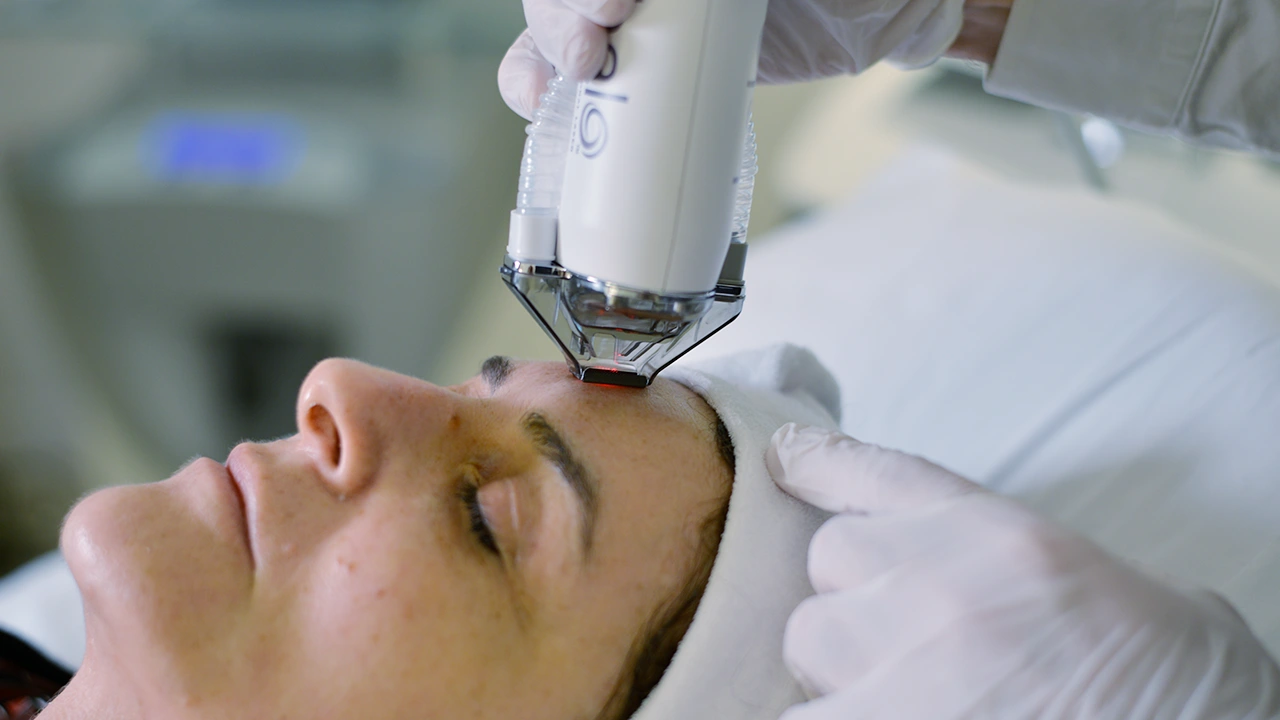 Une dame lors d'une séance de réjuvénation laser