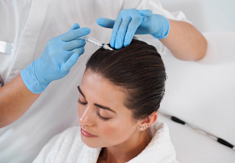 Greffe de cheveux femme