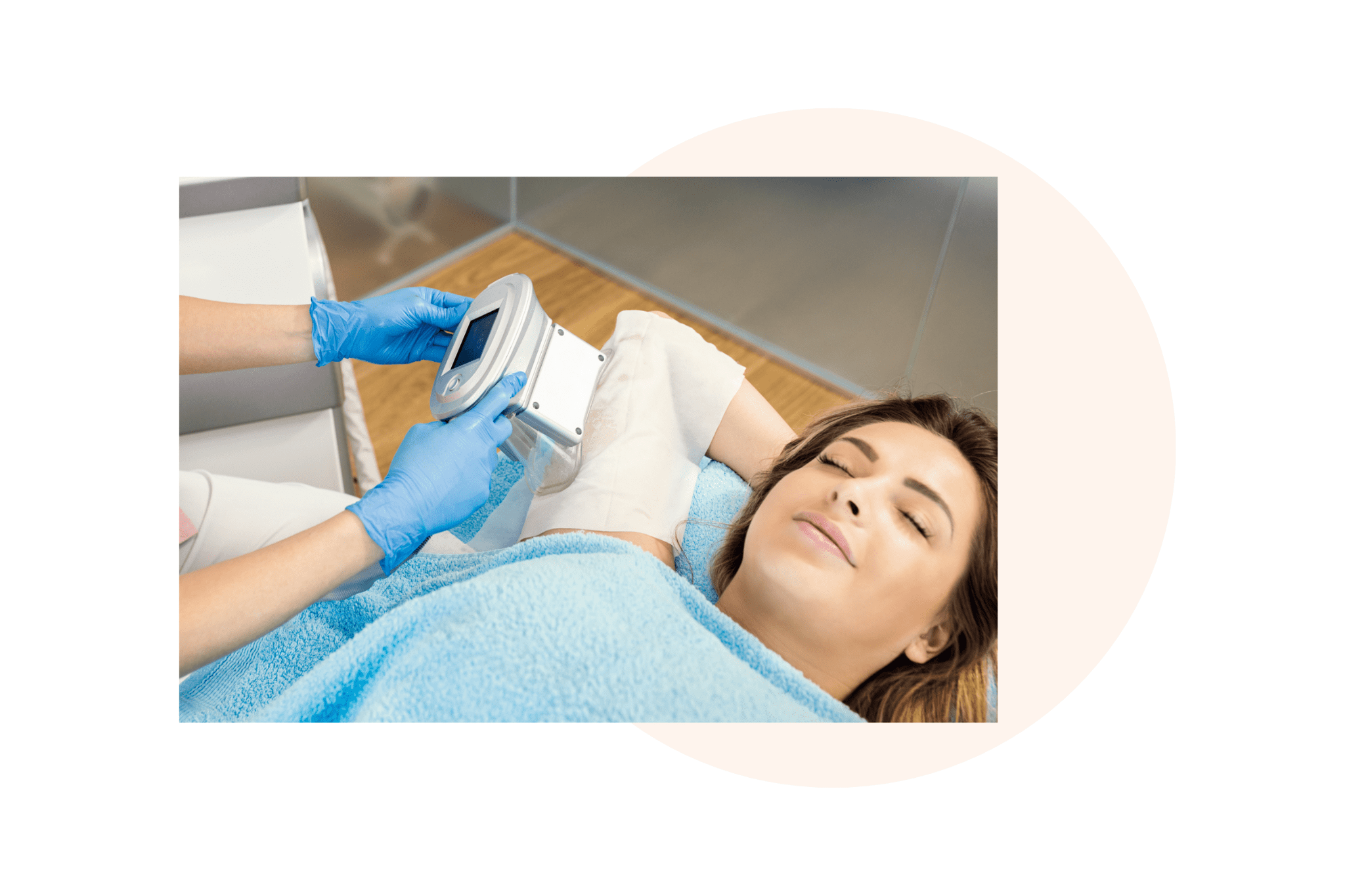 cryolipolyse sur le bras