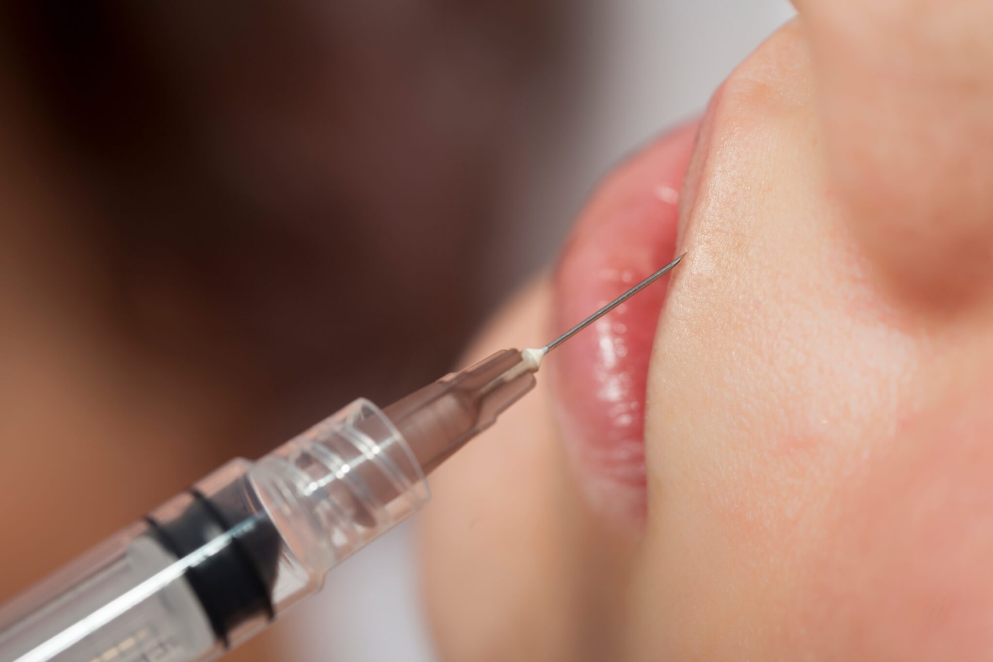 injection à Lille d'acide hyaluronique