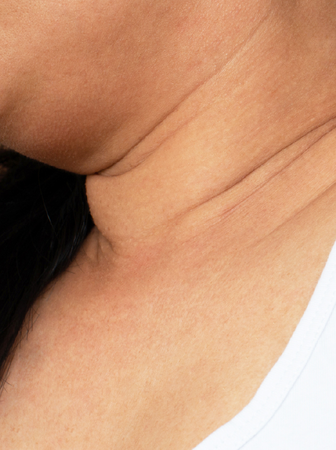 zoom sur un double menton