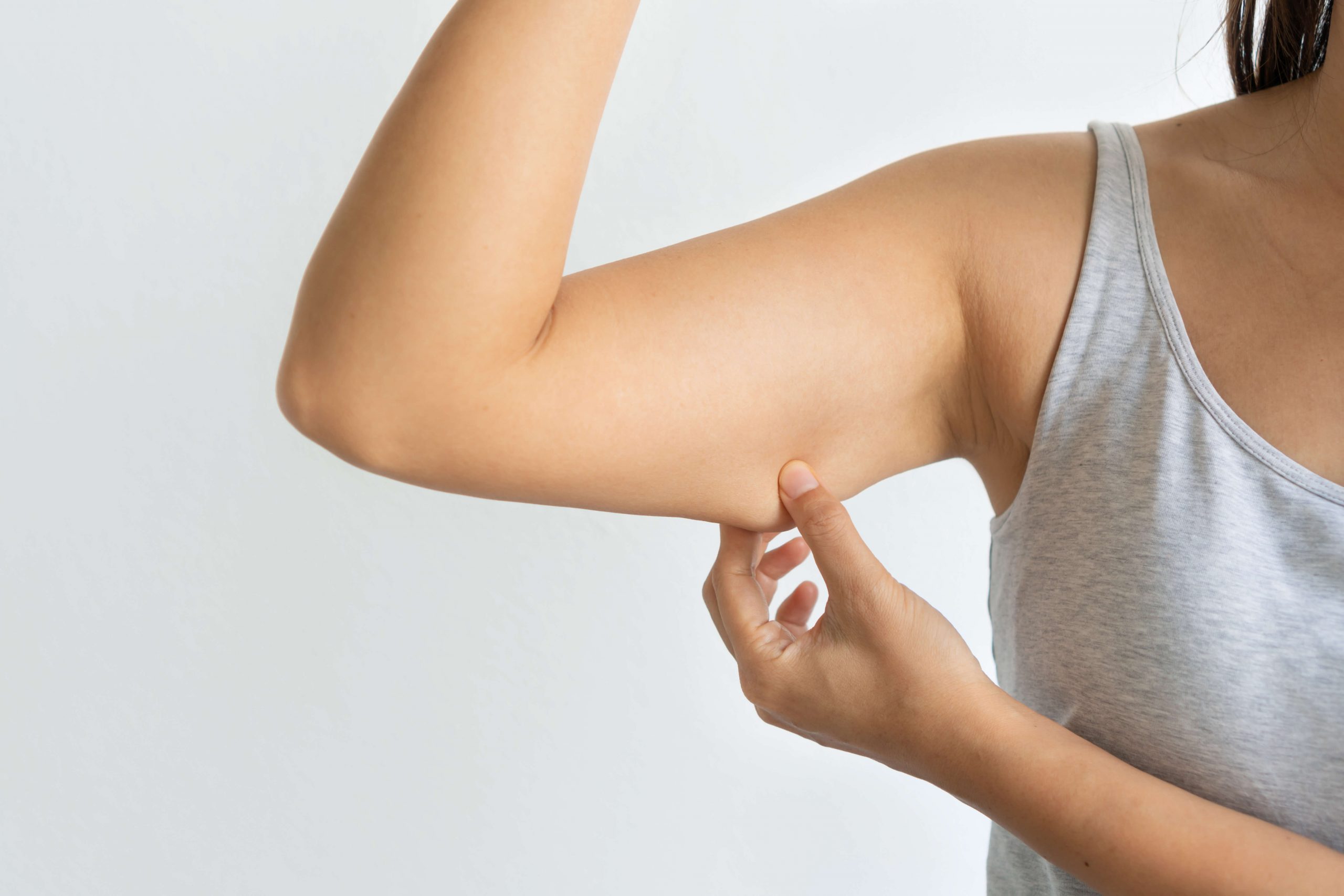 bras flasque avant cryolipolyse