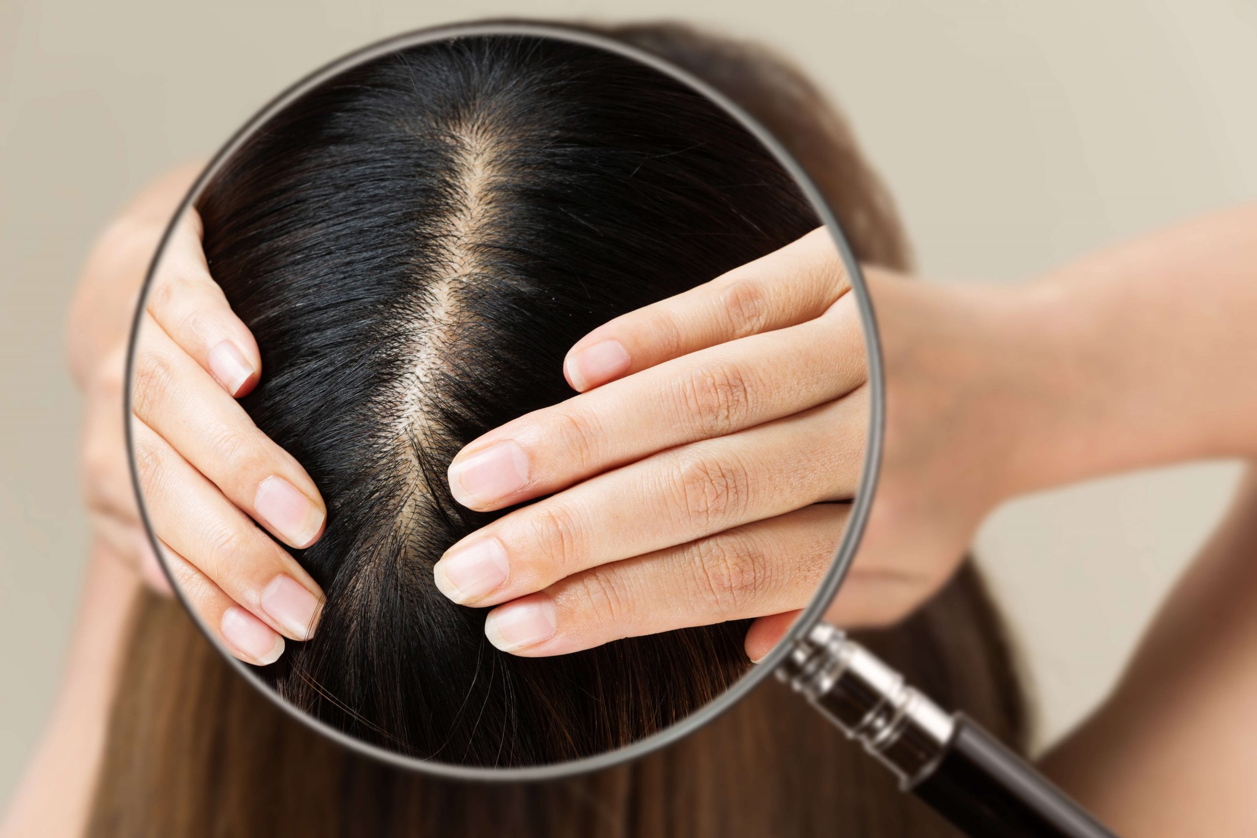 bilan santé cheveux