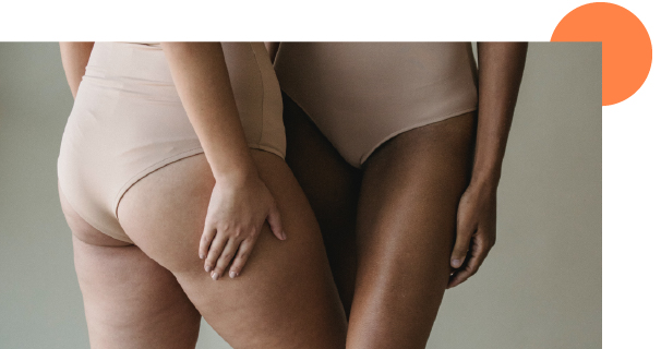 deux corps de femmes tronqués avec un zoom sur les cuisses et les fesses en besoin de raffermissement