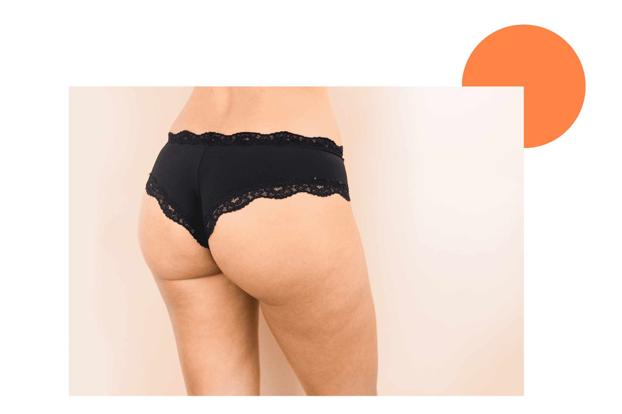 Cellulite sur les fesses et les cuisses d'une femme 
