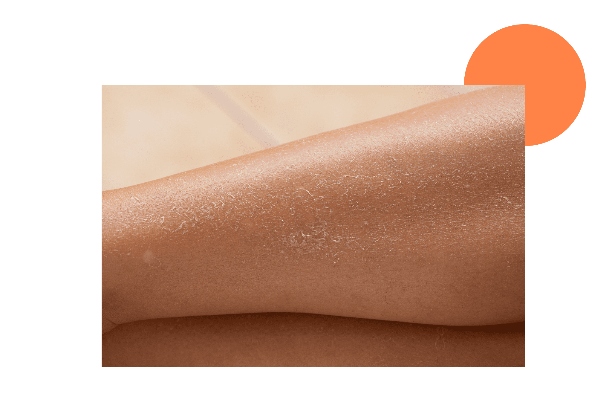 Jambes de femmes avec des petites croûtes