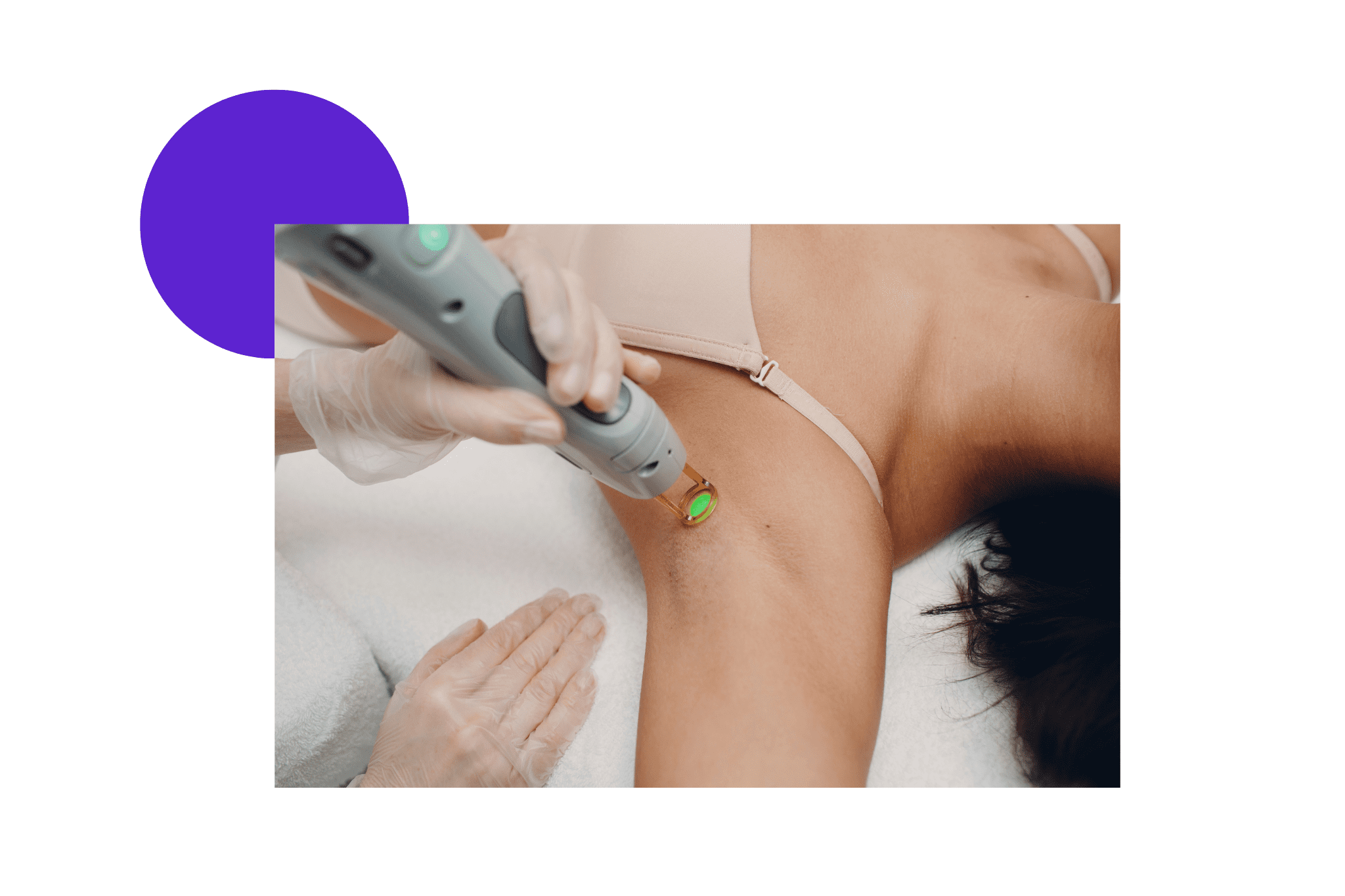 Épilation définitive au laser des aisselles