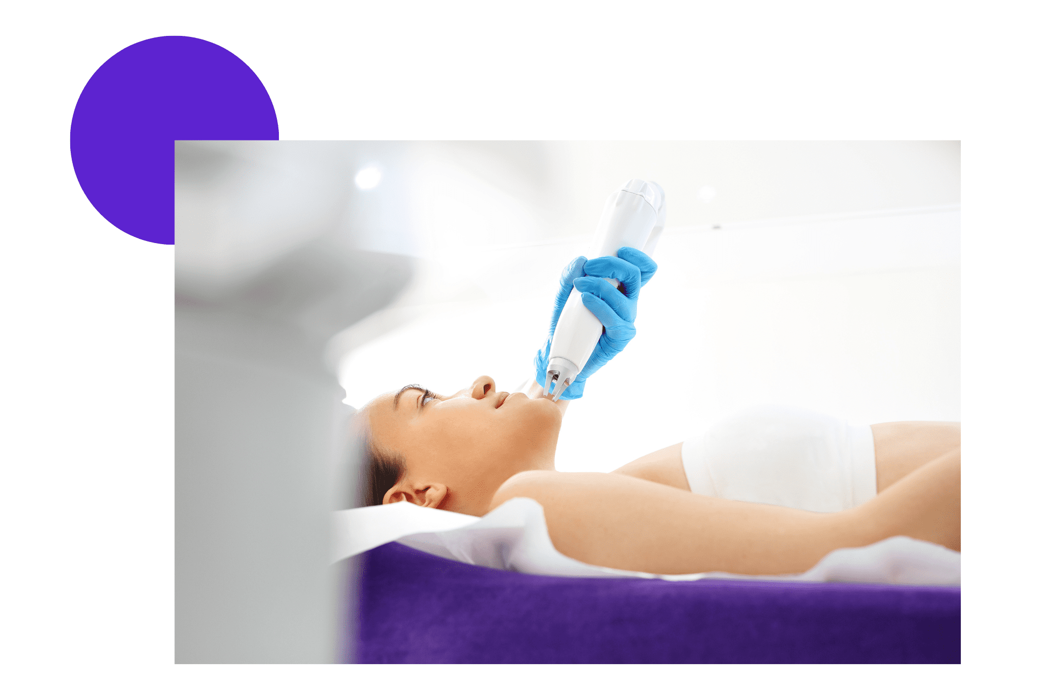 Épilation laser du menton d'une femme