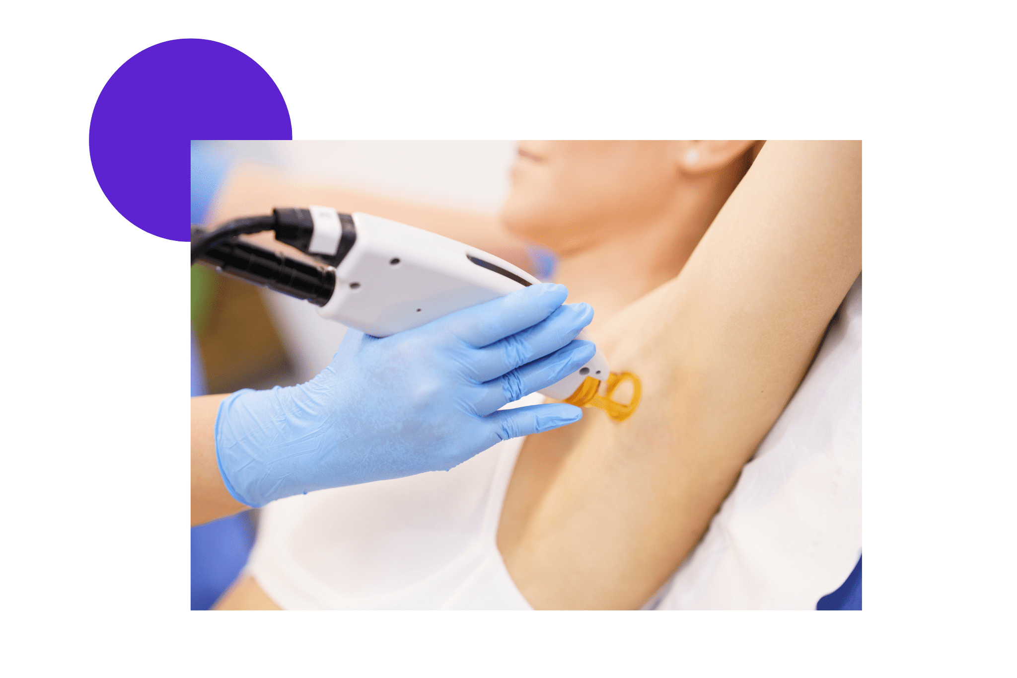 Femme qui se fait épiler les aisselles au laser