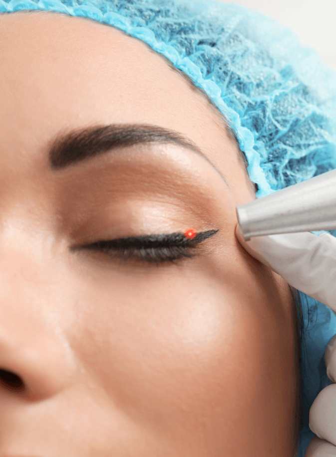 séance de detatouage eyeliner yeux