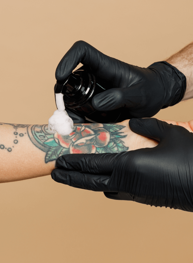 acide lactique sur bras tatoué