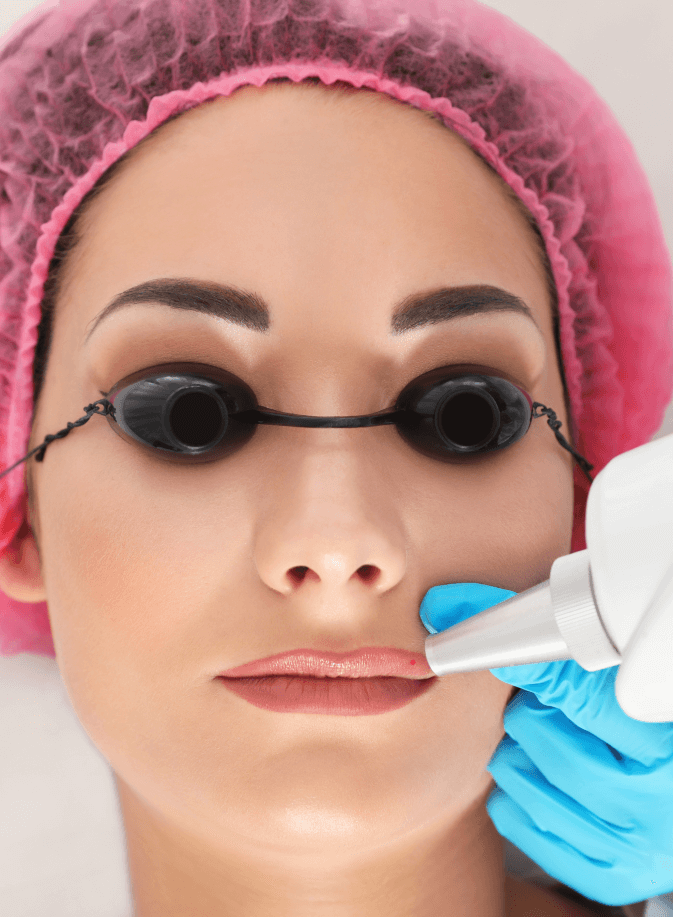 séance de detatouage contour levres bouche