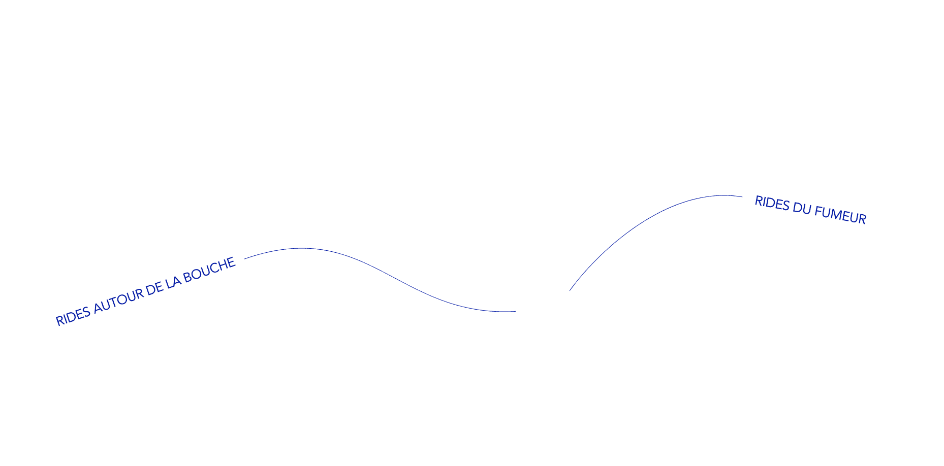 tracés des rides péri-buccales