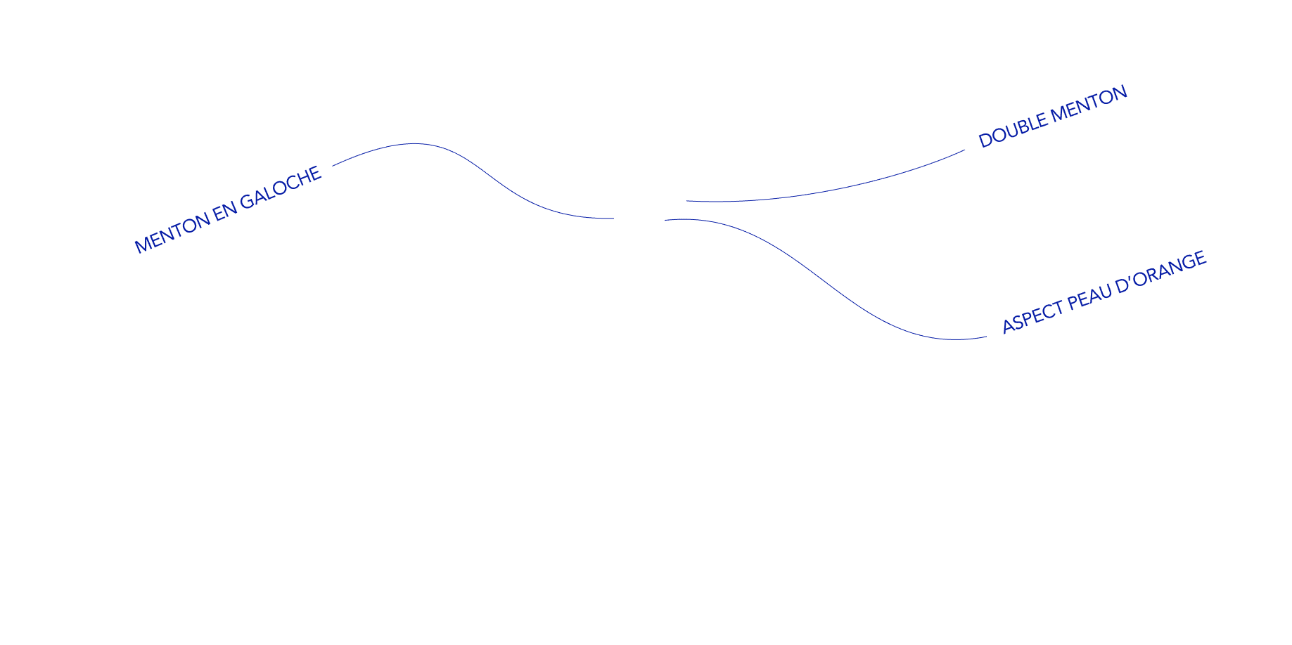 tracé menton