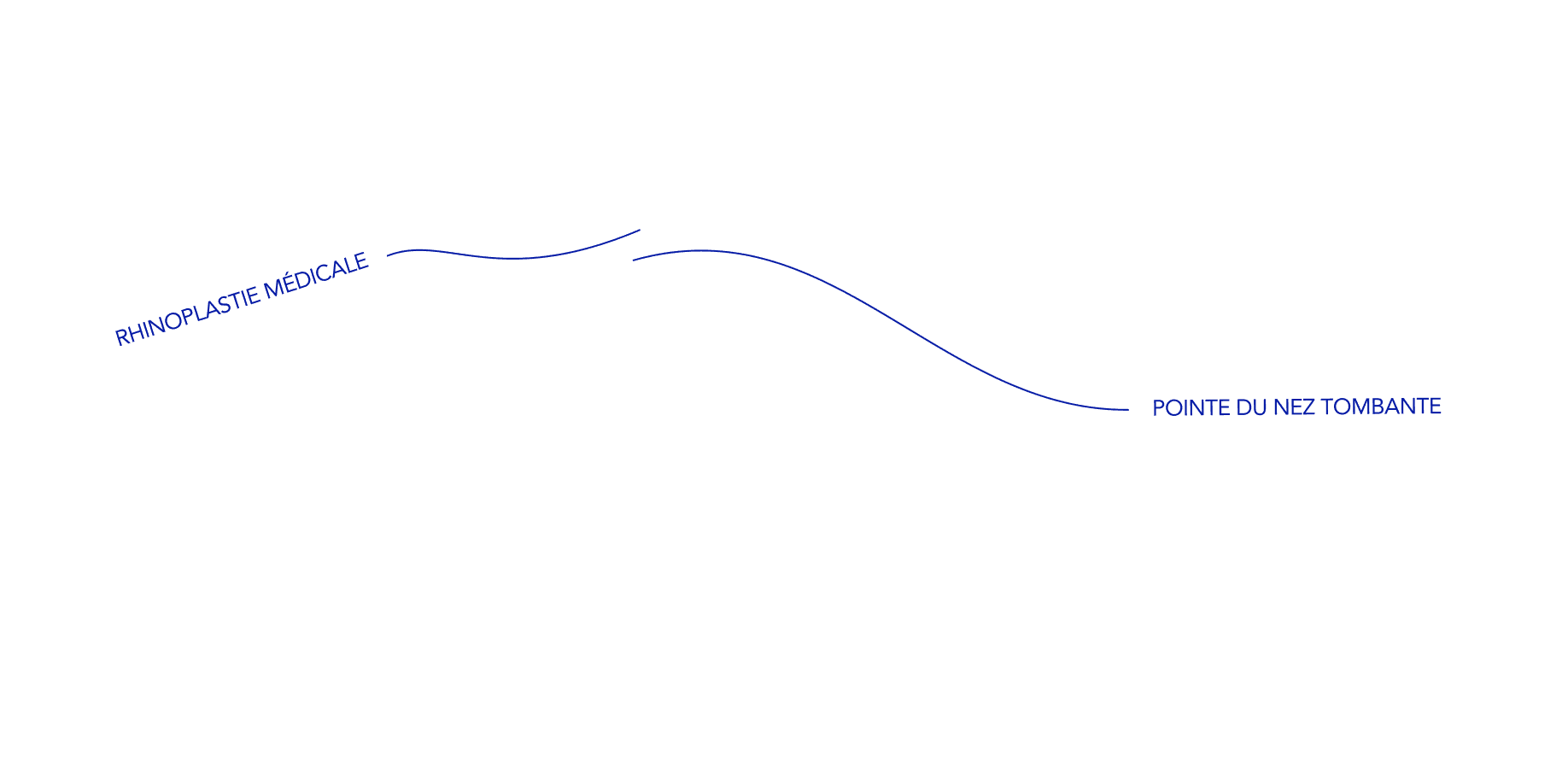 tracé nez