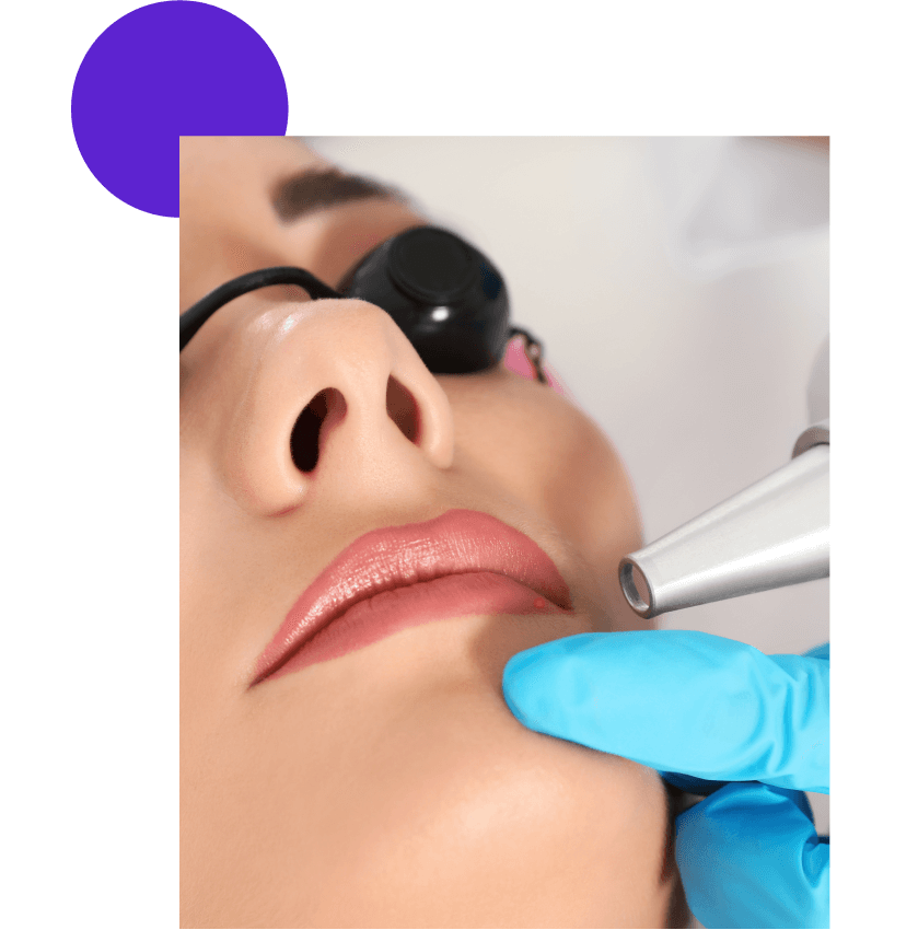 detatouage laser levres et bouche