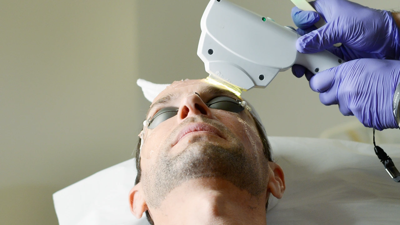 Patient en séance d'IPL