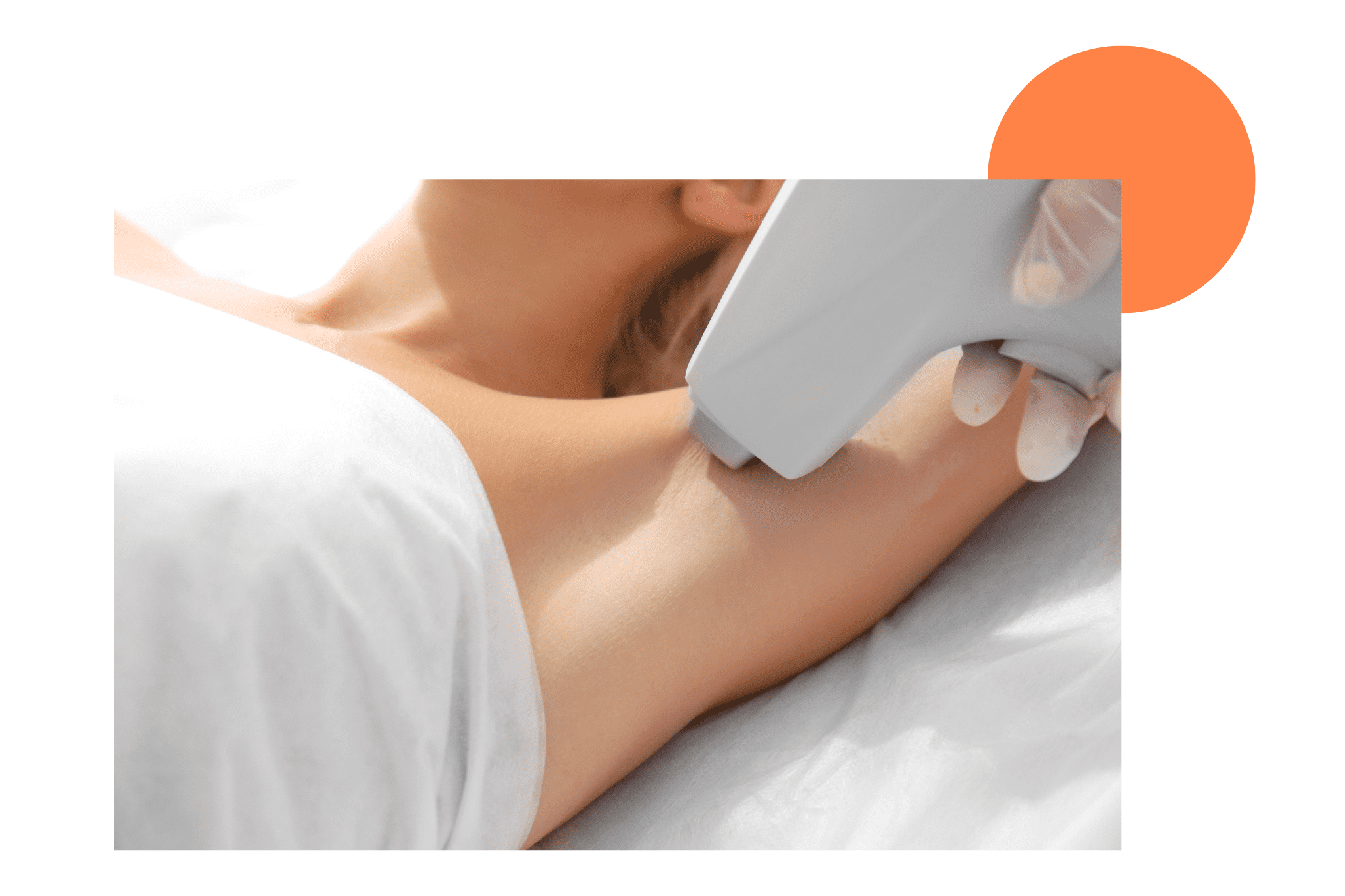 Épilation à la lumière pulsée des aisselles