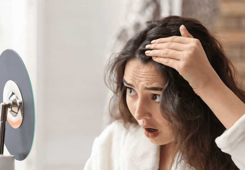 une femme qui a une perte de cheveux