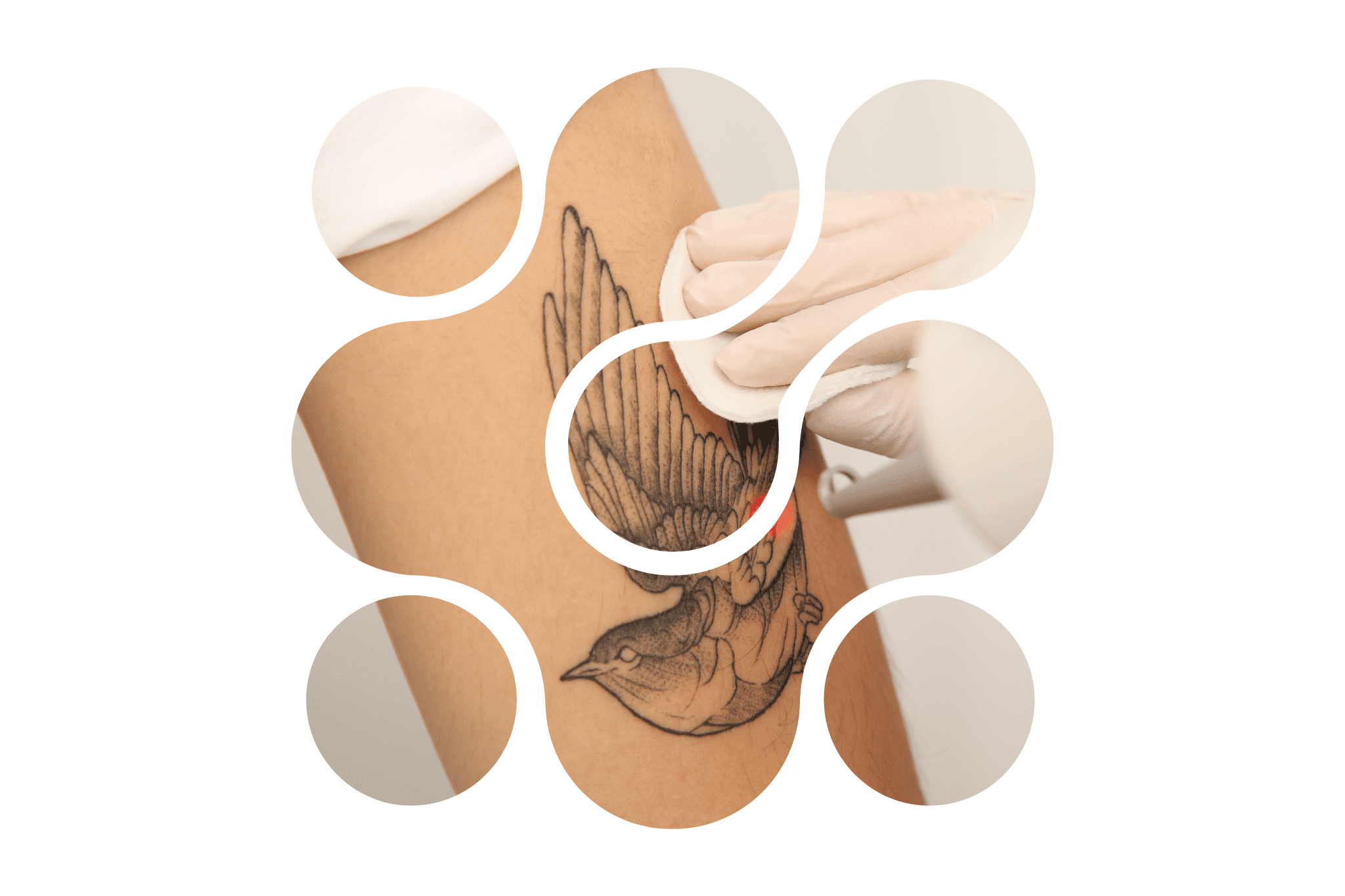 Picto FAQ détatouage