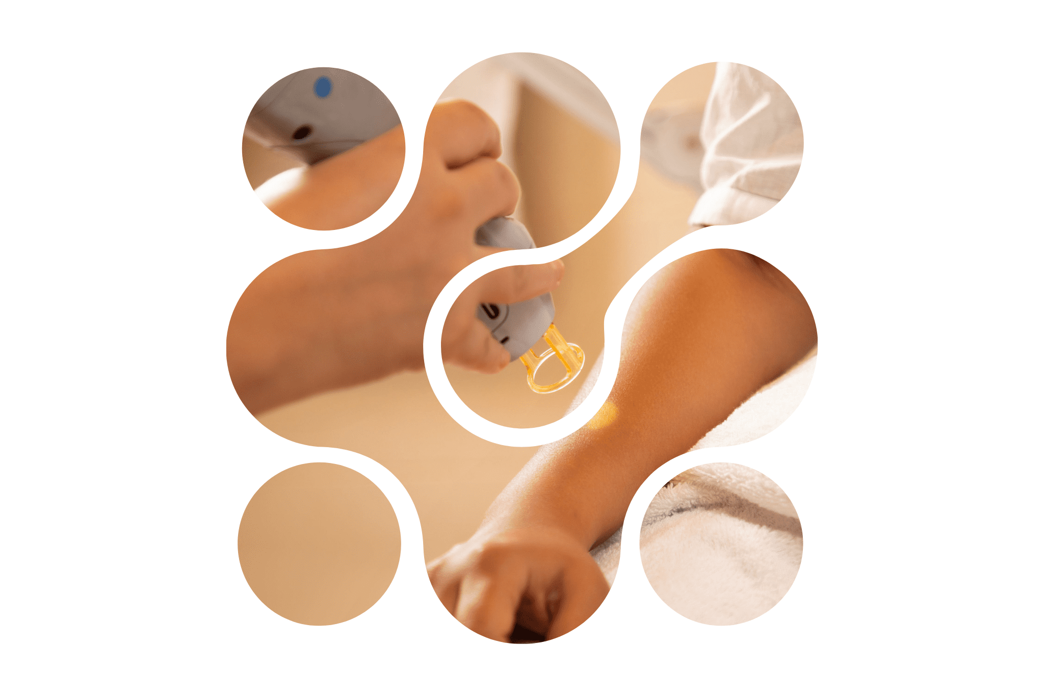 Picto laser sur un bras