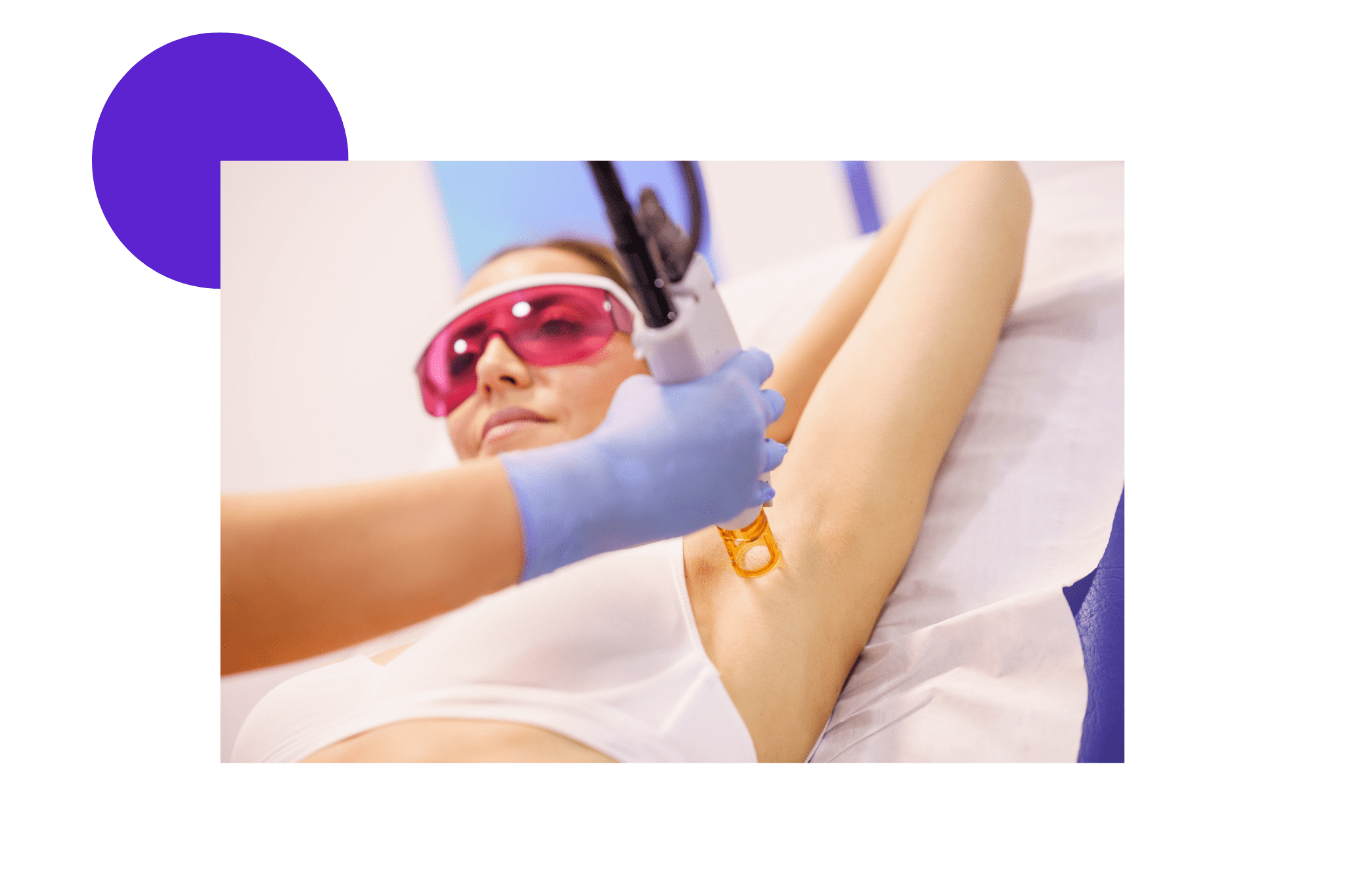 Séance d'épilation laser sur une aisselle