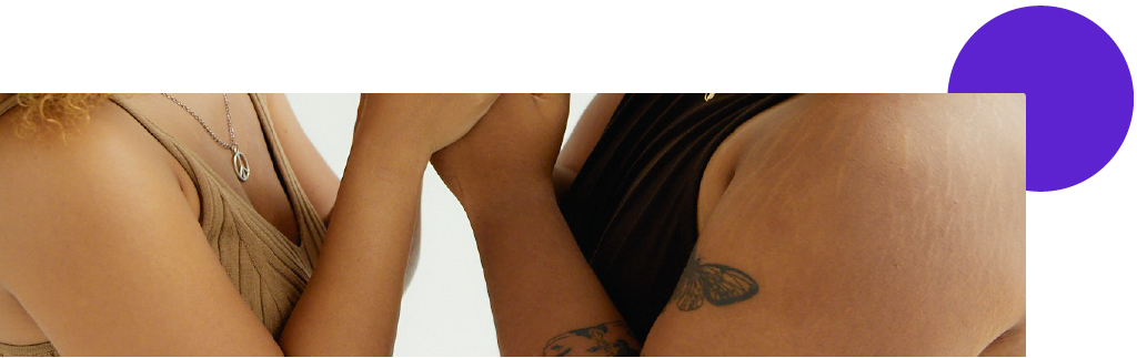 vergetures sur deux bras