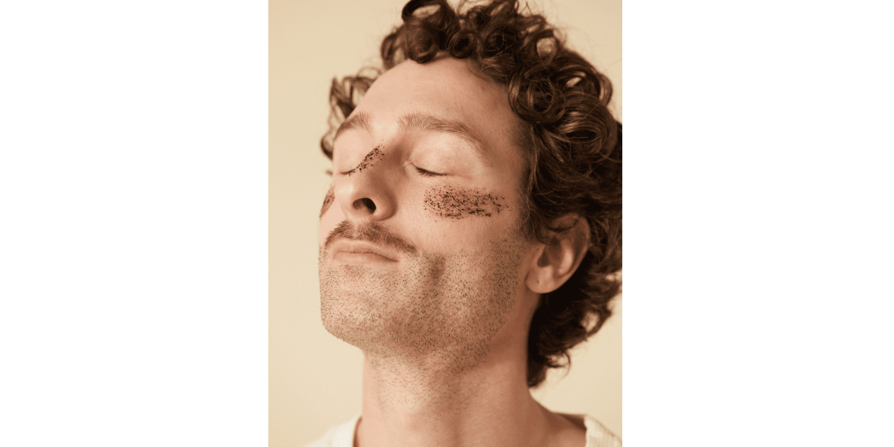 acné mineur sur le visage d'un garçon