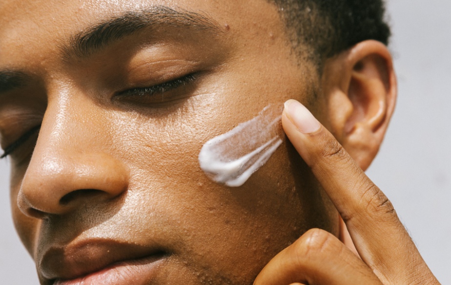 acné sur un homme noir