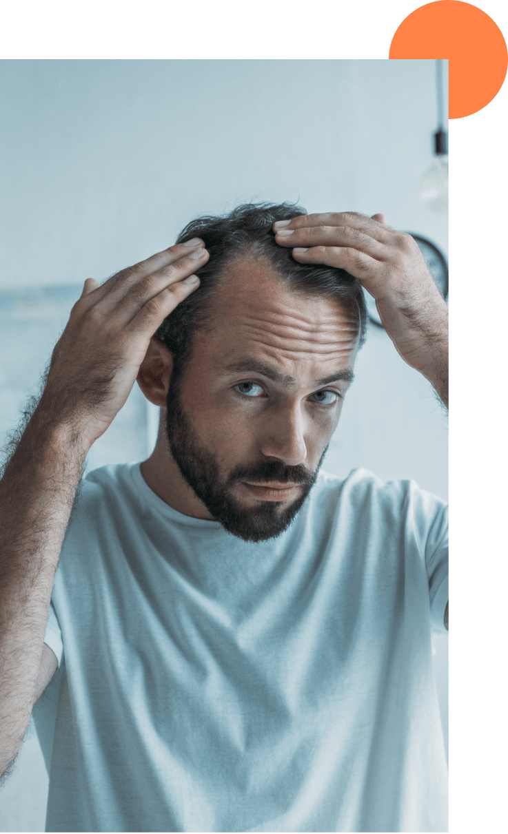 homme qui regarde son alopécie dans le miroir