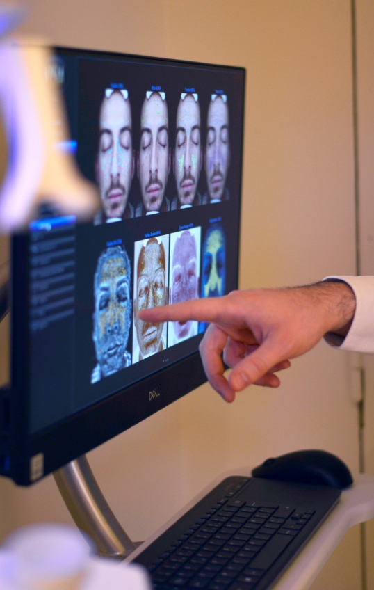 analyse de peau avec le Visia 7