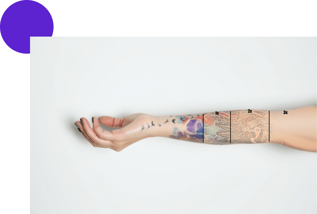 avant apres au fil des seances tatouage sur le bras