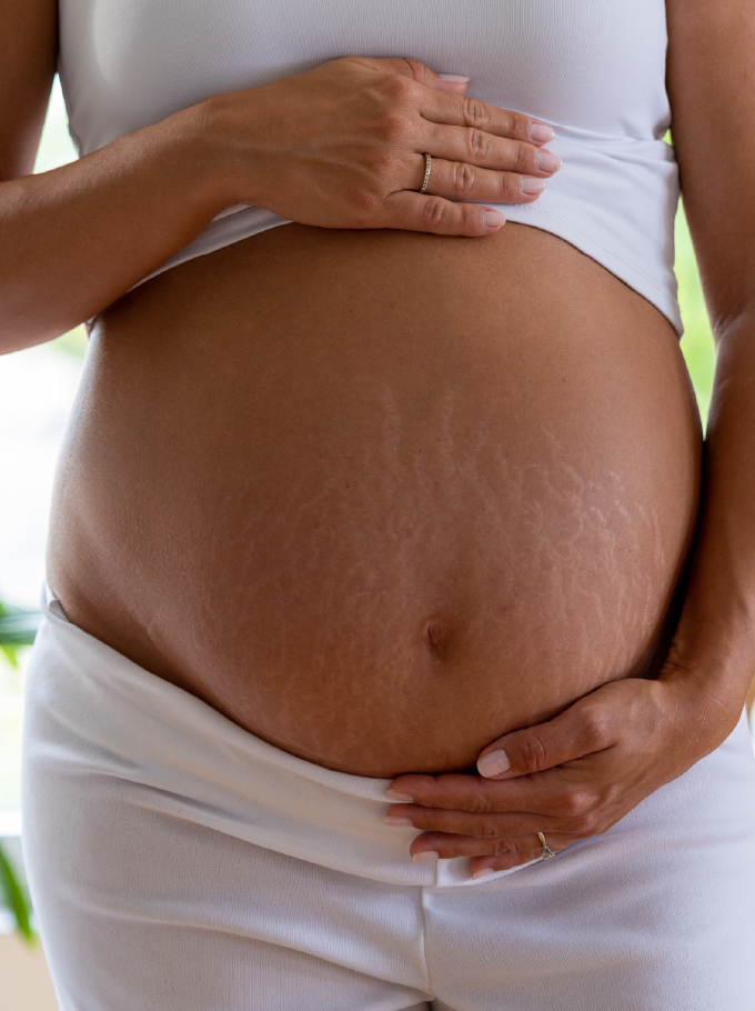 vergetures sur ventre de femme enceinte