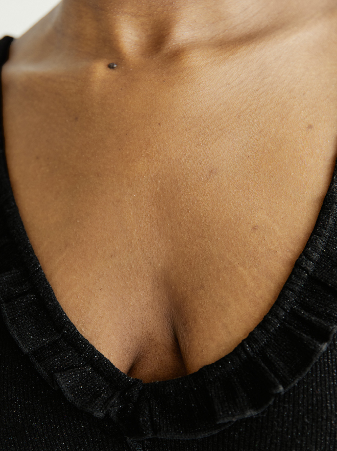 vergetures haut de la poitrine et du buste