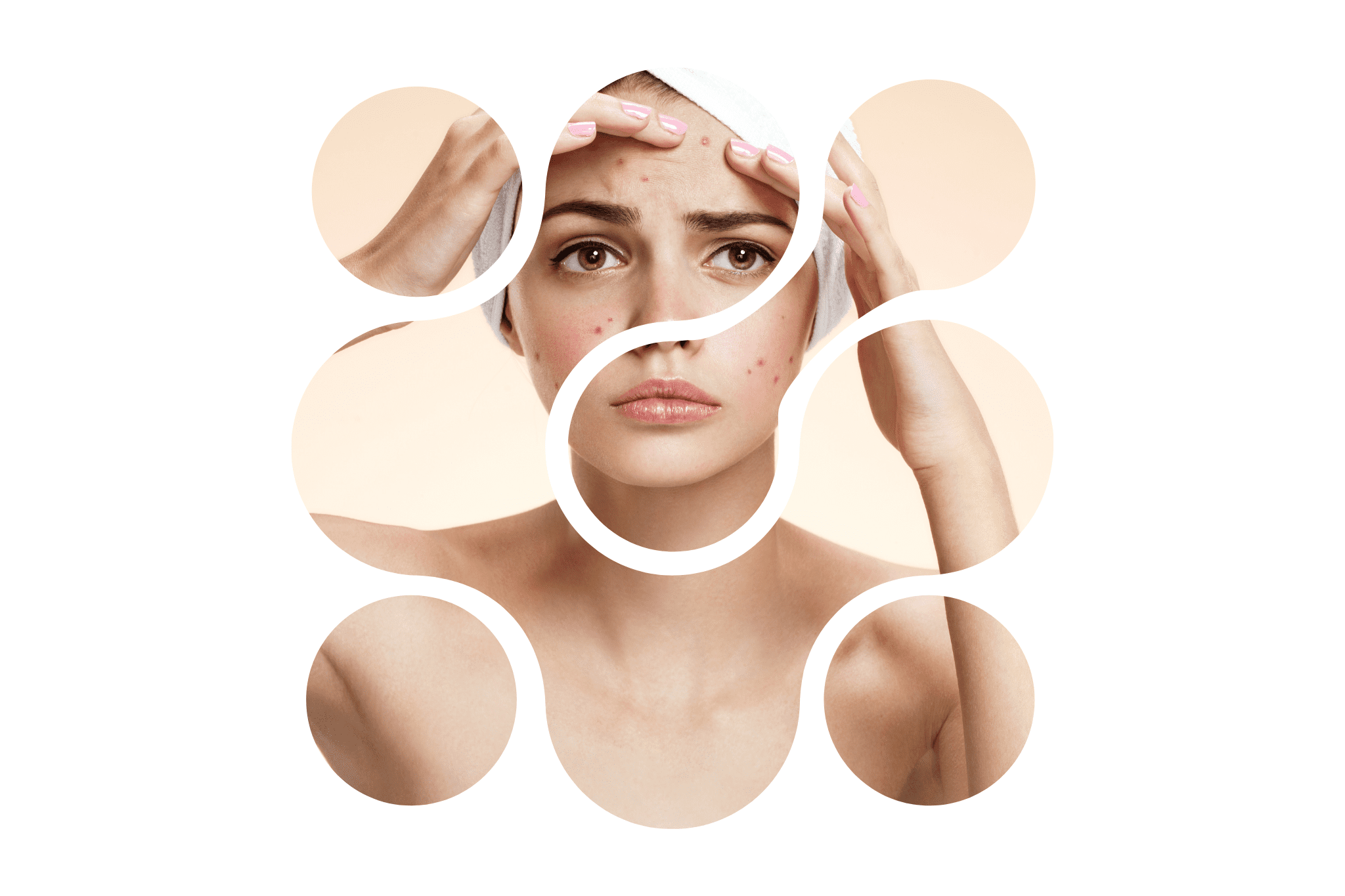 une femme qui a des boutons rouges sur le visage