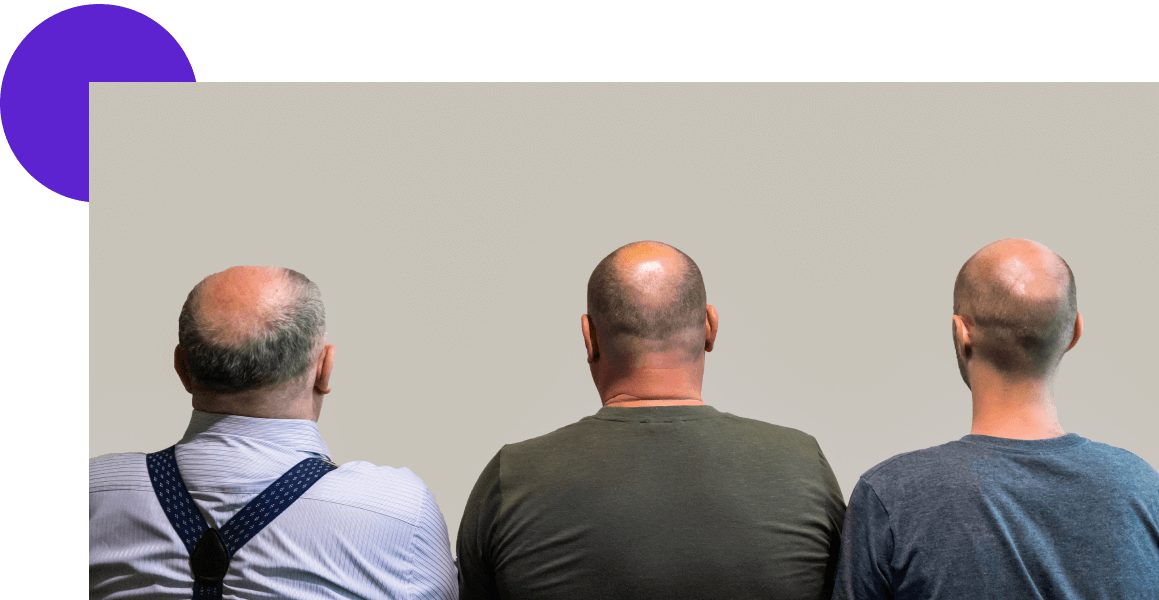 grand pere , pere et fils avec calvitie