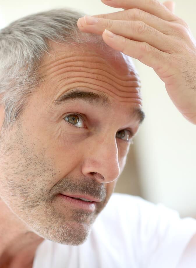 homme qui regarde sa calvitie