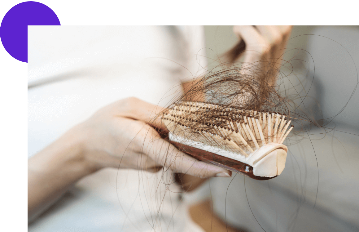 cancer perte cheveux sur brosse