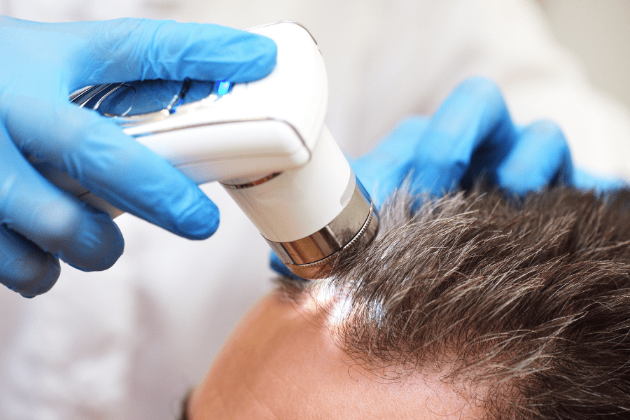 Un monsieur qui fait une analyse complète de son cuir chevelu grâce à la trichologie