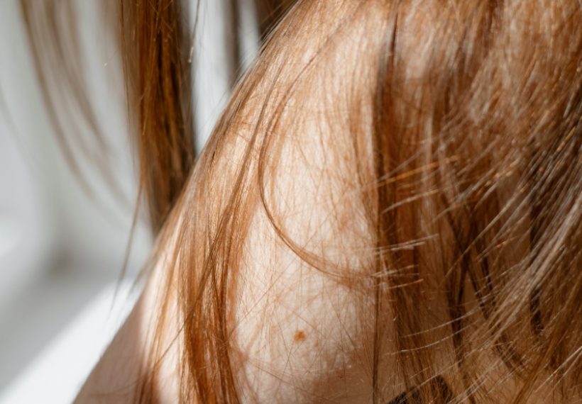 une femme qui souffre de chute capillaire à cause du stress