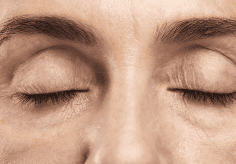 Une femme qui vient faire rajeunir son visage chez aesthé