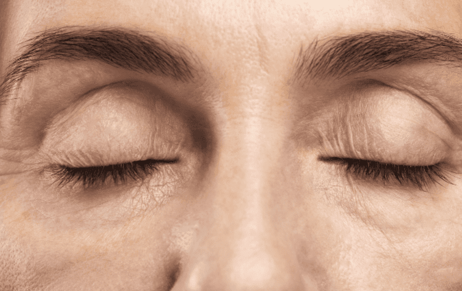 Une femme qui vient faire rajeunir son visage chez aesthé