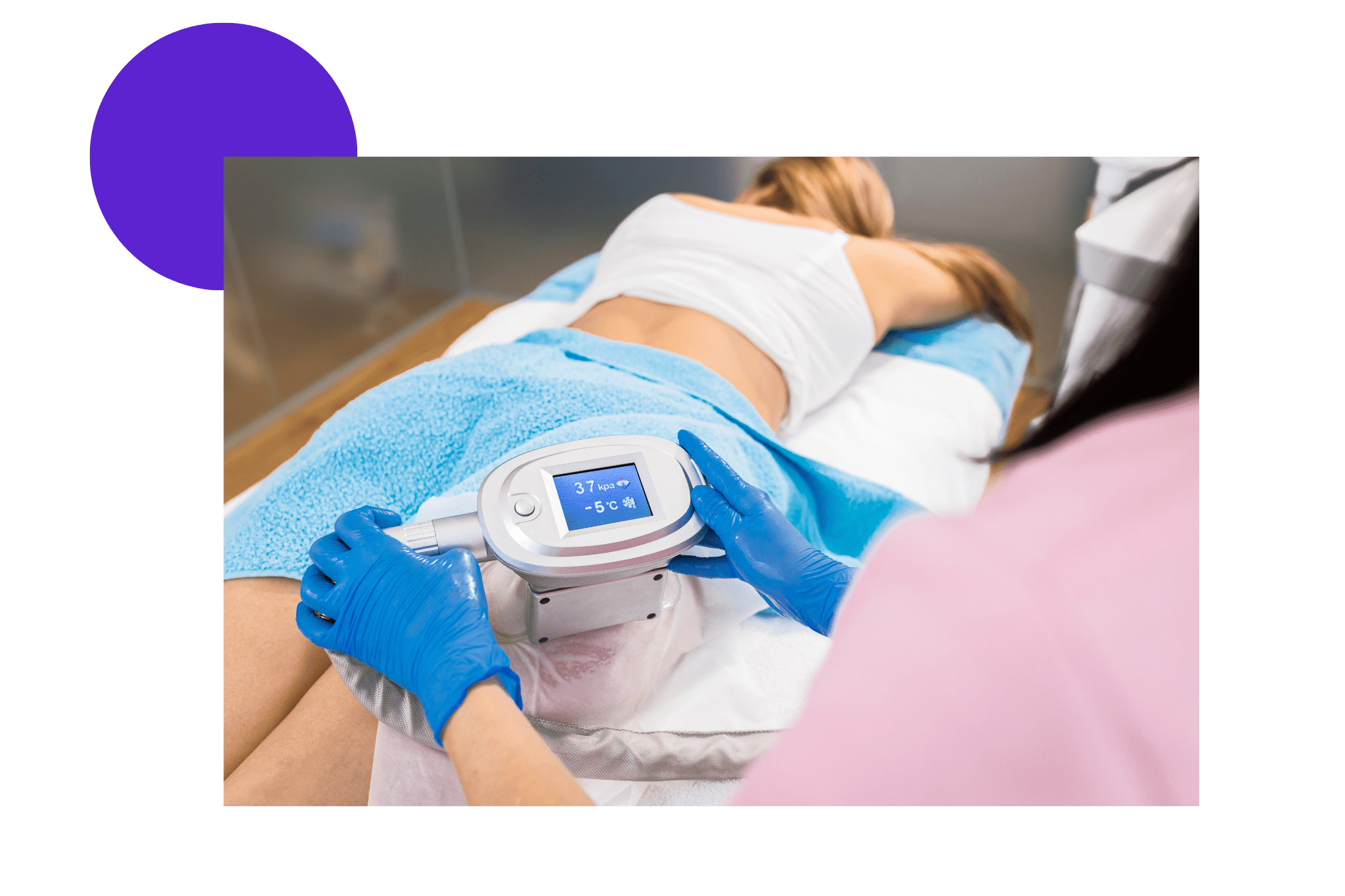 séance de cryolipolyse sur les cuisses