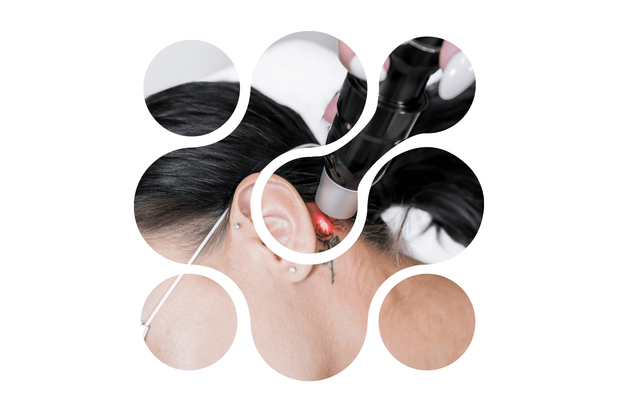 détatouage d'une rose derrière l'oreille d'une femme