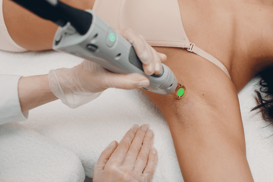 Une femme qui fait une séance d'épilation laser des aisselles après avoir pris en compte les contre-indications