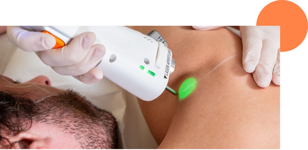 Une séance d'épilation laser sur les bras d'une personne chez aesthé