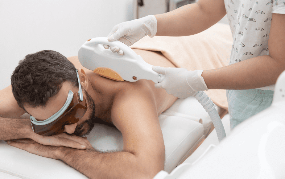 épilation laser du dos sur un homme