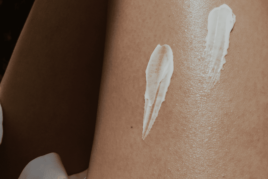 Une personne qui s'applique la crème anesthésiante emla la veille de sa séance d'épilation laser