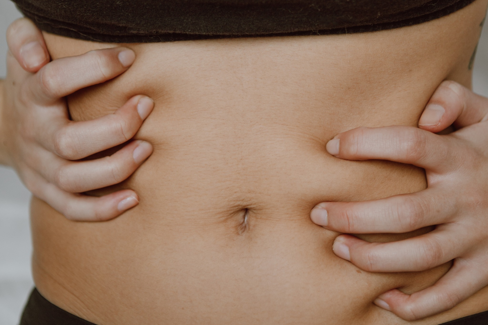 une femme qui n'a plus de bourrelet apres ses séances de cryolipolyse